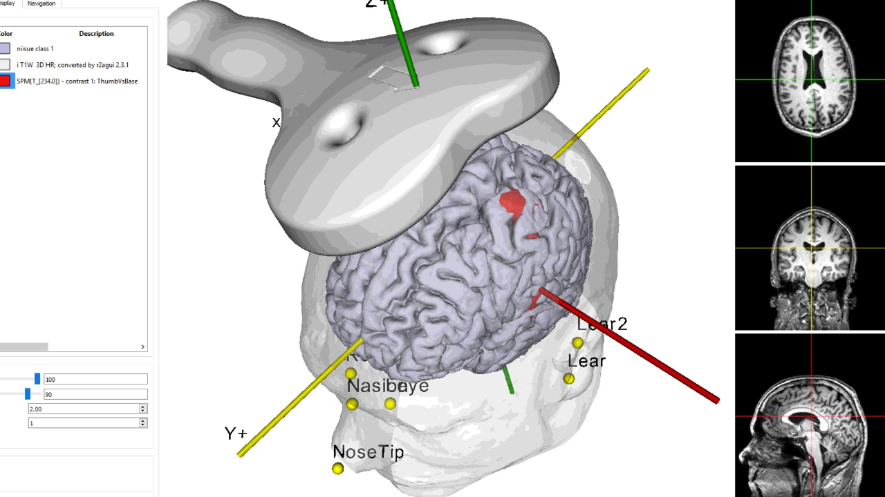 TMS El Paso - Alfredo H. Arellano Pmhcns- BC, PA - Psychiatry & TMS Clinic | Beech Location - TMS Clinic in El Paso, TX